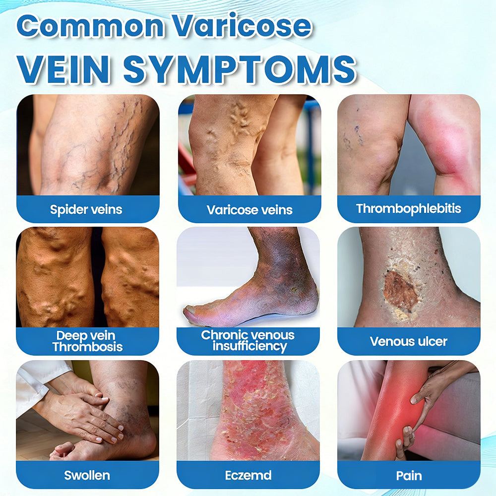 🇦🇺✅GFOUK® VascuCare Vein Healing Spray(Designed for Varicose veins, Spider veins, Deep vein Thrombosis, Chronic venous insufficiency, Venous ulcers, Thrombophlebitis and other venous issues)