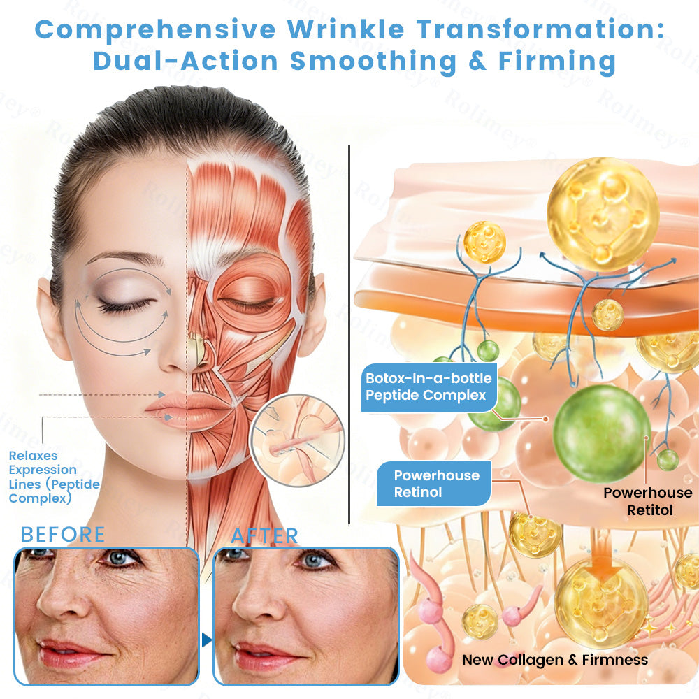 🇦🇺🎁Rolimey® Botox + Retinol Skin Firming & Lifting Cream⏰For Aging issues