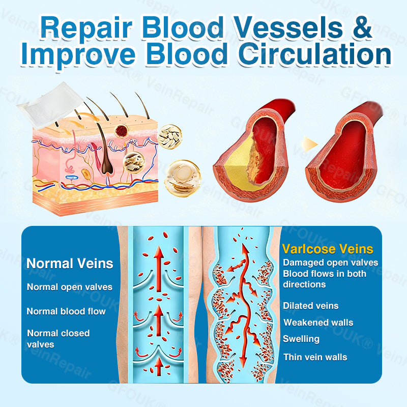 🇦🇺✅👨‍⚕️🫶GFOUK® VeinRepair Microneedle Patch Roll⚡Instant Relief, Long-Term Results