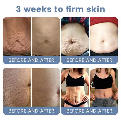 🇦🇺💎Rolimey® Advanced Botox Peptide Retinol Firming & Lifting Cream⏰LAST DAY 80% OFF