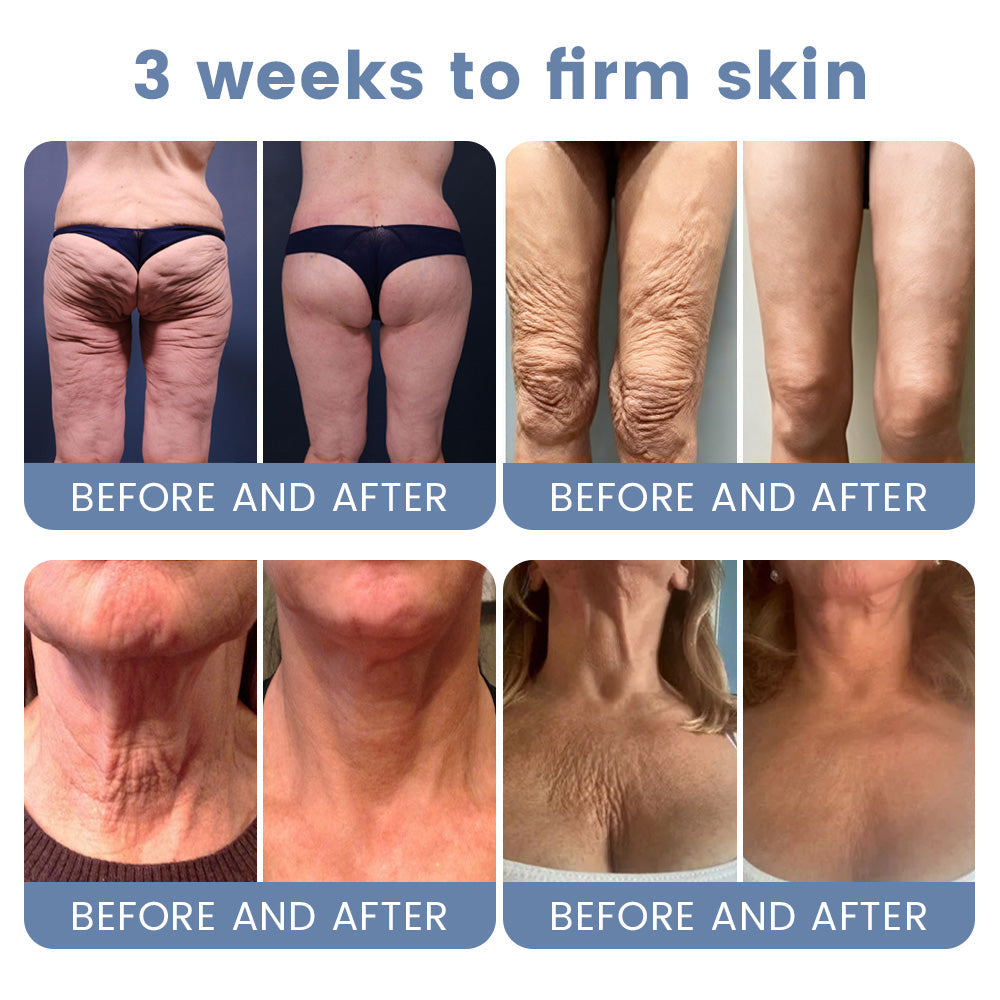 🇦🇺💎Rolimey® Advanced Botox Peptide Retinol Firming & Lifting Cream⏰LAST DAY 80% OFF