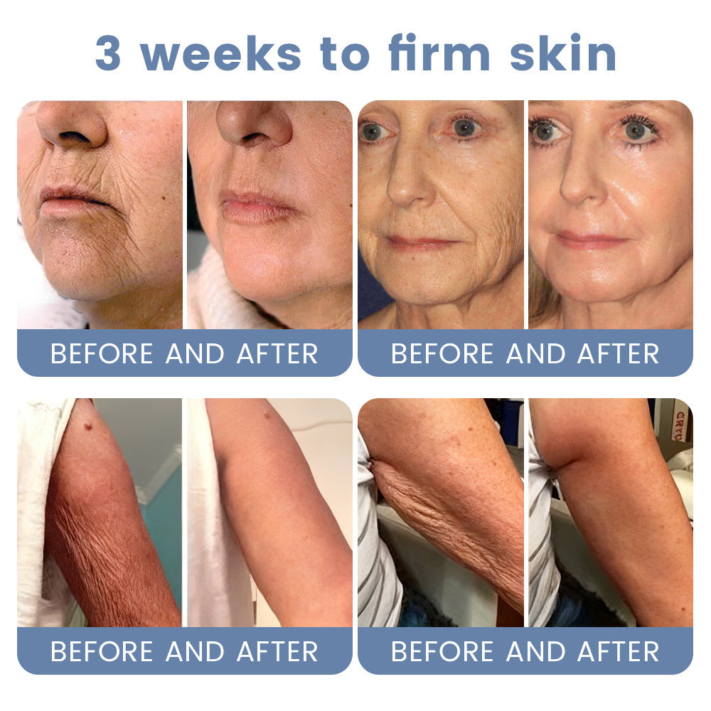 🇦🇺💎Rolimey® Advanced Botox Peptide Retinol Firming & Lifting Cream⏰LAST DAY 80% OFF