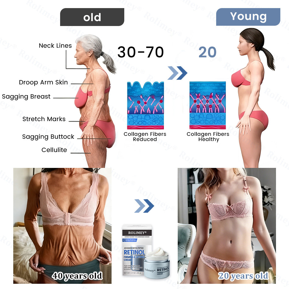 🇦🇺💎Rolimey® Advanced Botox Peptide Retinol Firming & Lifting Cream⏰LAST DAY 80% OFF