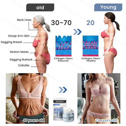 🇦🇺💎Rolimey® Advanced Botox Peptide Retinol Firming & Lifting Cream⏰LAST DAY 80% OFF