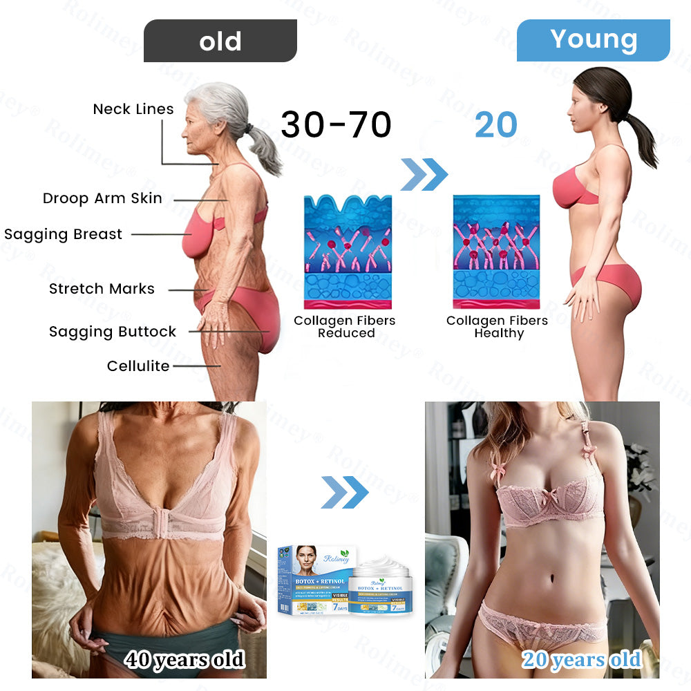 🇦🇺🎁Rolimey® Botox + Retinol Skin Firming & Lifting Cream⏰For Aging issues