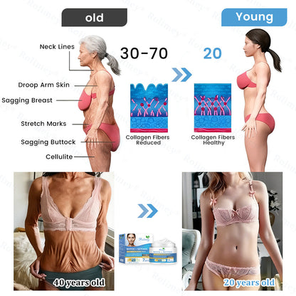 🇦🇺🎁Rolimey® Botox + Retinol Skin Firming & Lifting Cream⏰For Aging issues