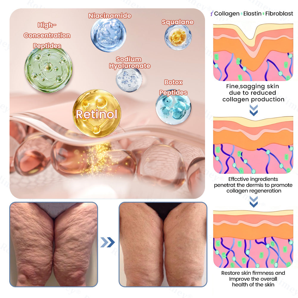 🇦🇺💎Rolimey® Advanced Botox Peptide Retinol Firming & Lifting Cream⏰LAST DAY 80% OFF