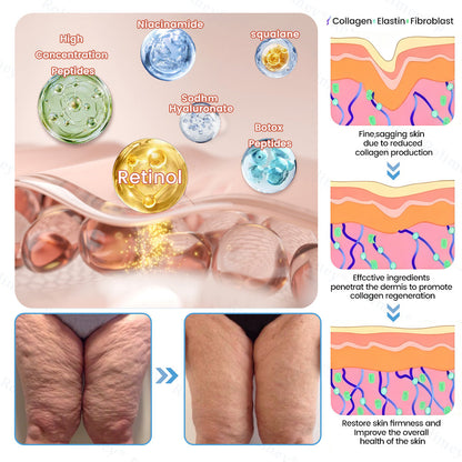 🇦🇺🎁Rolimey® Botox + Retinol Skin Firming & Lifting Cream⏰For Aging issues