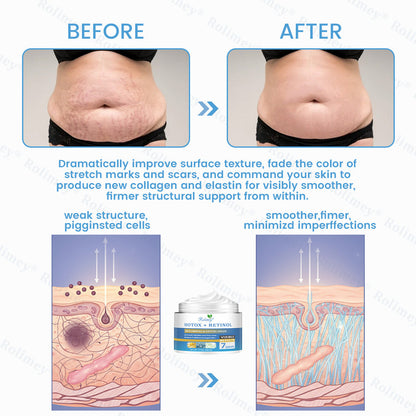 🇦🇺🎁Rolimey® Botox + Retinol Skin Firming & Lifting Cream⏰For Aging issues