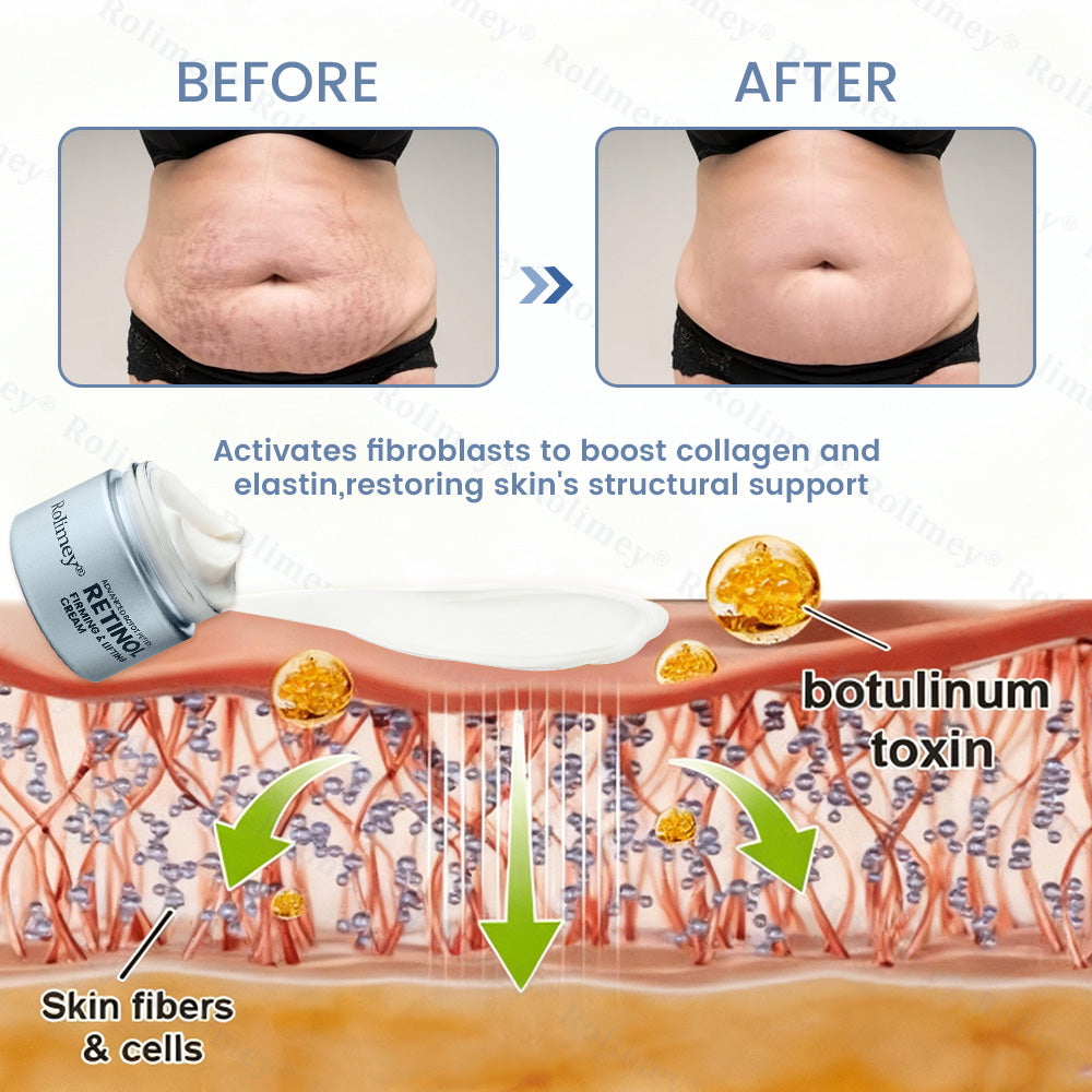 🇦🇺💎Rolimey® Advanced Botox Peptide Retinol Firming & Lifting Cream⏰LAST DAY 80% OFF