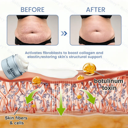 🇦🇺💎Rolimey® Advanced Botox Peptide Retinol Firming & Lifting Cream⏰LAST DAY 80% OFF