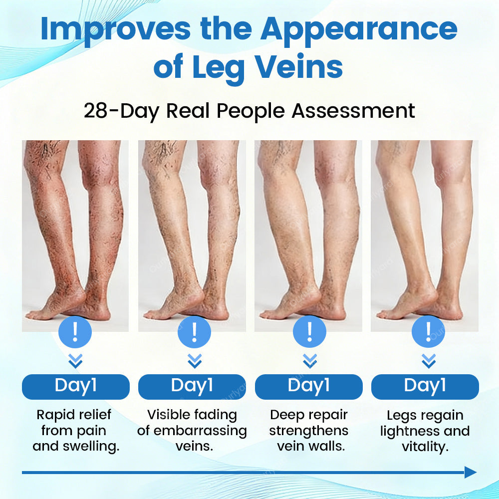 🇦🇺✅Ourlyard® VascuCare Vein Healing Spray(Designed for Varicose veins, Spider veins, Deep vein Thrombosis, Chronic venous insufficiency, Venous ulcers, Thrombophlebitis and other venous issues)
