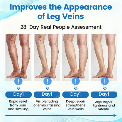 🇦🇺✅Ourlyard® VascuCare Vein Healing Spray(Designed for Varicose veins, Spider veins, Deep vein Thrombosis, Chronic venous insufficiency, Venous ulcers, Thrombophlebitis and other venous issues)