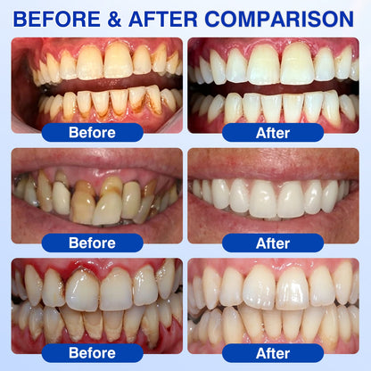 🇦🇺👨‍⚕️✅😁Evolvion® GumRevive Periodontal Repair Gel