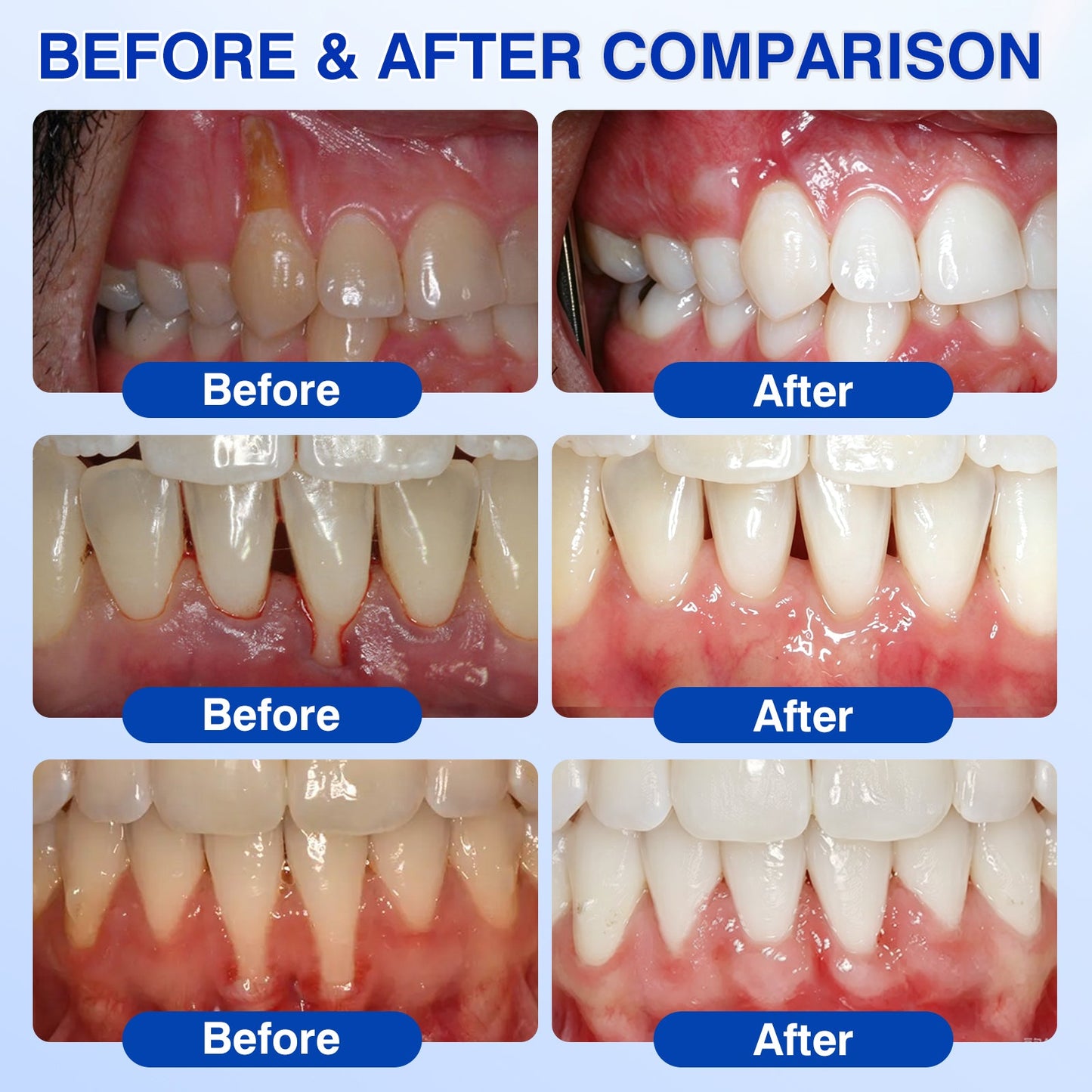 🇦🇺👨‍⚕️✅😁Evolvion® GumRevive Periodontal Repair Gel