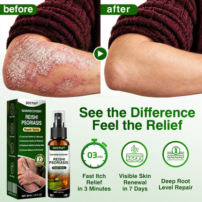 🇦🇺🏅🛡️✅DOCTIA® SkinRecovery Reishi Psoriasis Repair Spray