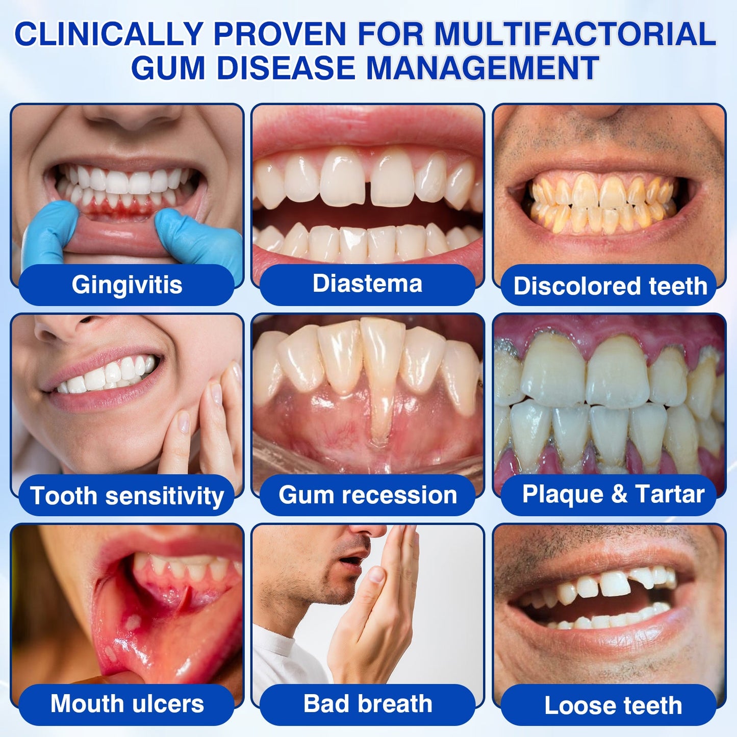 🇦🇺👨‍⚕️✅😁Evolvion® GumRevive Periodontal Repair Gel