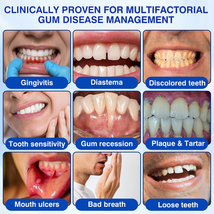 🇦🇺👨‍⚕️✅😁Evolvion® GumRevive Periodontal Repair Gel