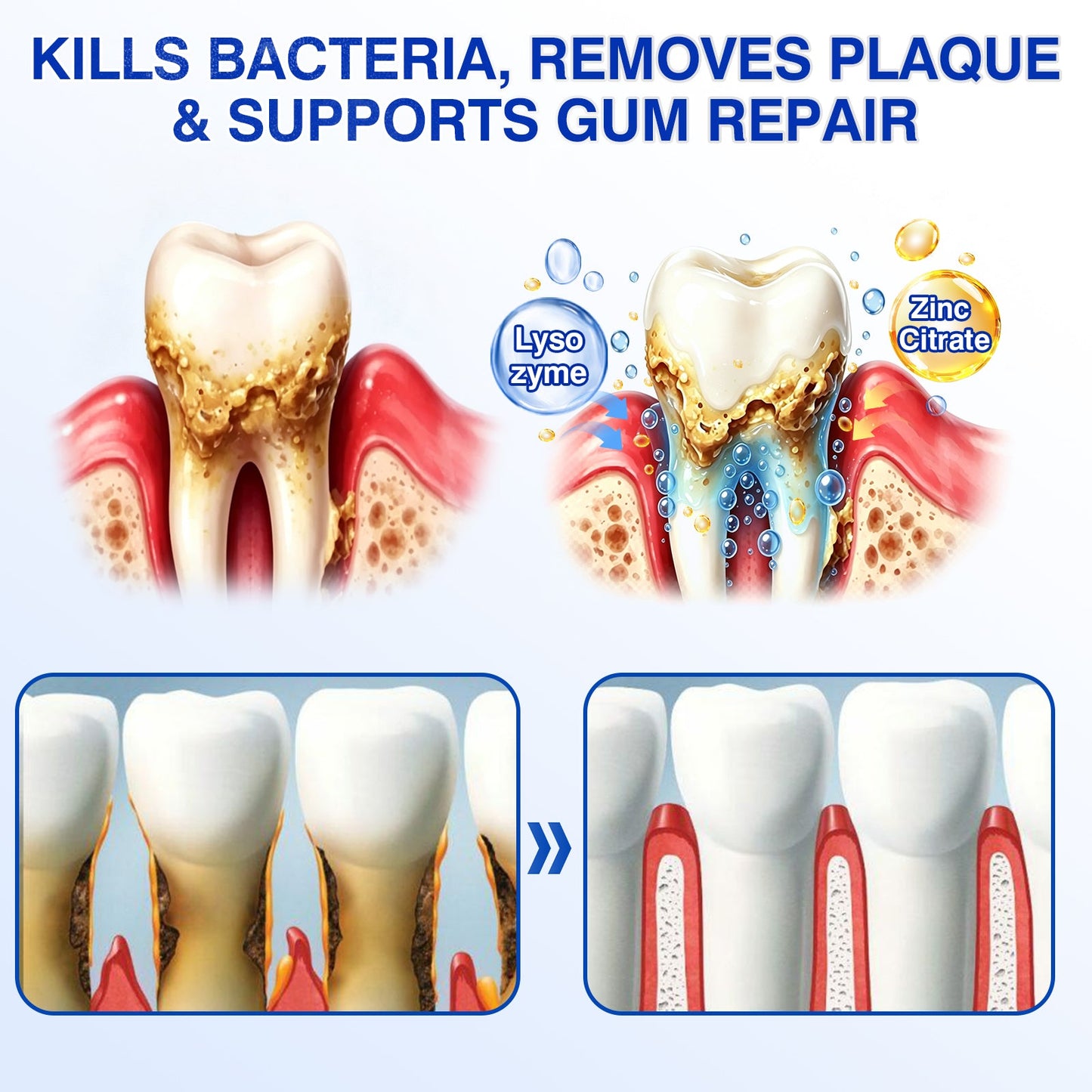 🇦🇺👨‍⚕️✅😁Evolvion® GumRevive Periodontal Repair Gel