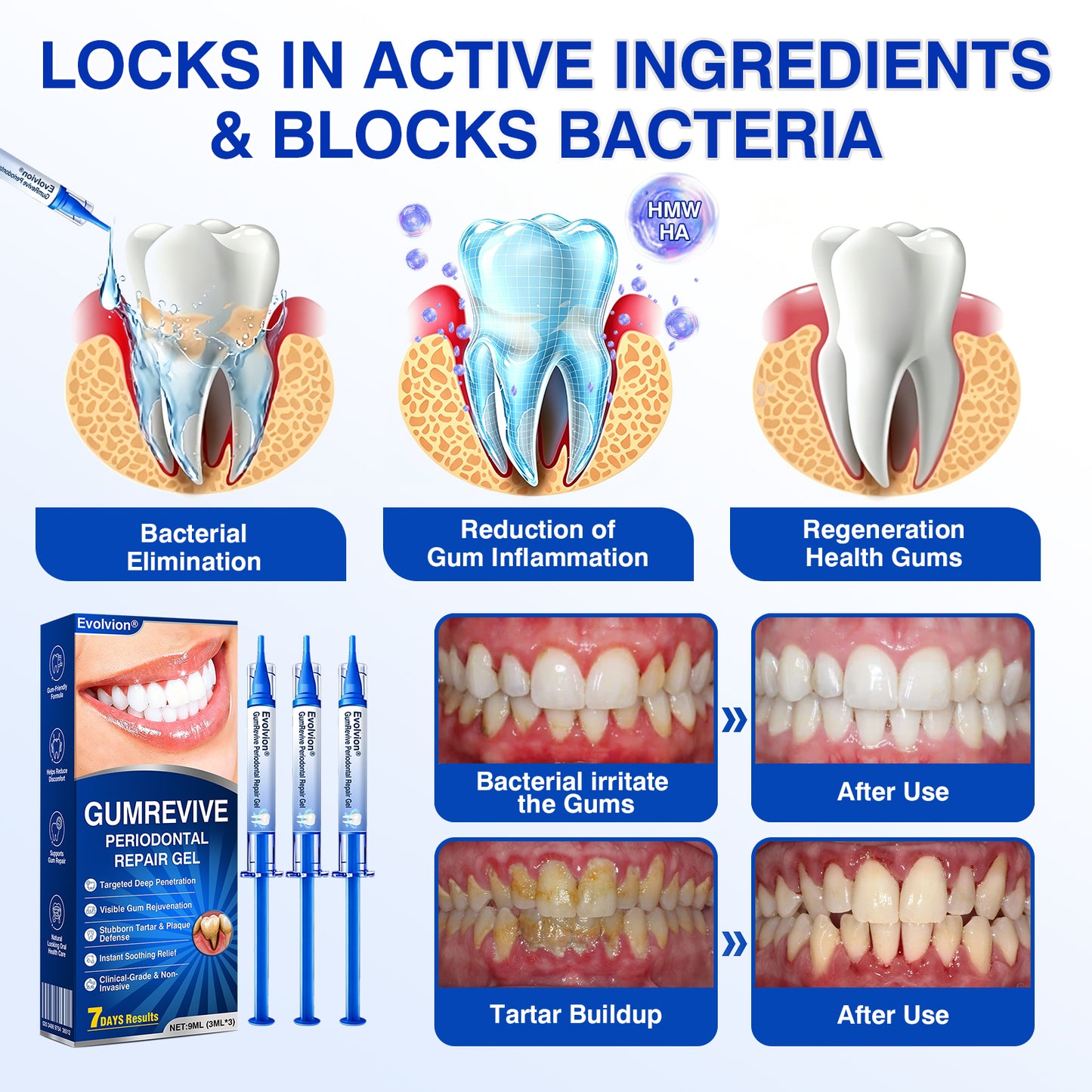 🇦🇺👨‍⚕️✅😁Evolvion® GumRevive Periodontal Repair Gel