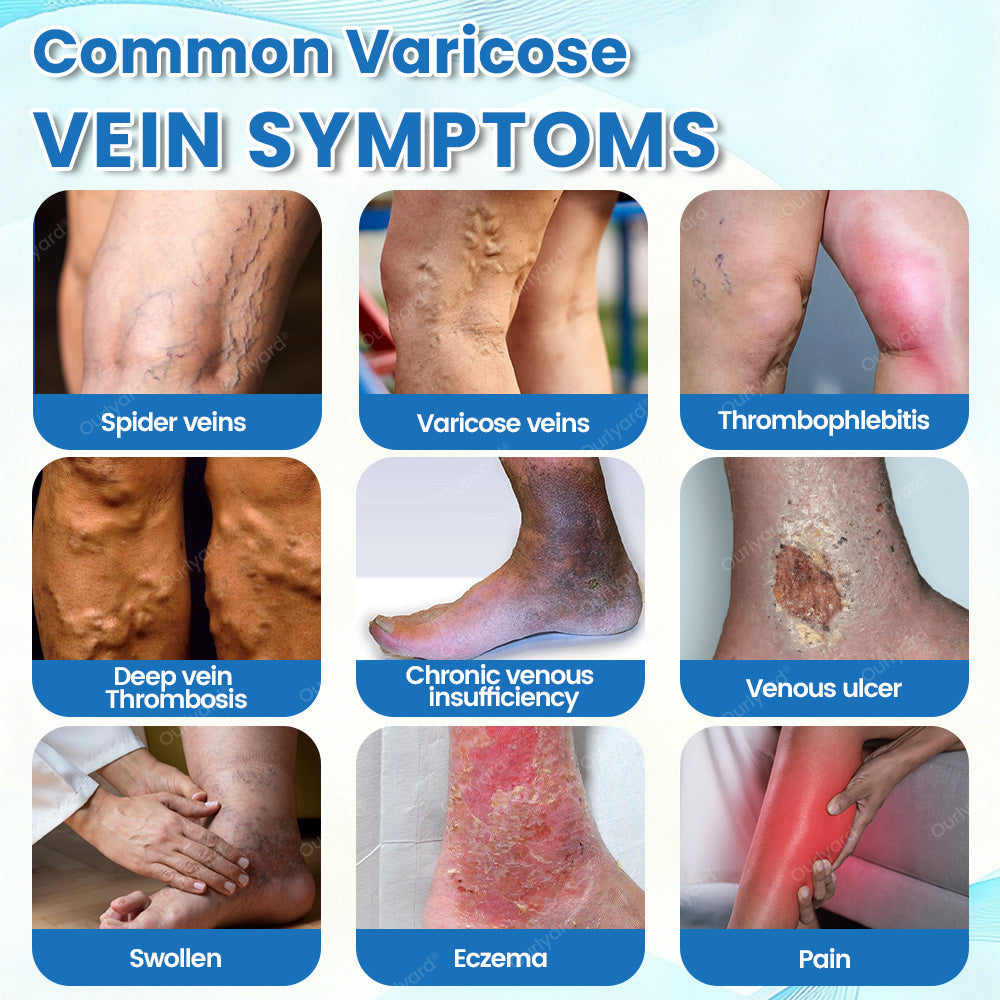 🇦🇺✅Ourlyard® VascuCare Vein Healing Spray(Designed for Varicose veins, Spider veins, Deep vein Thrombosis, Chronic venous insufficiency, Venous ulcers, Thrombophlebitis and other venous issues)