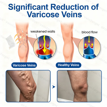 🇦🇺👨‍⚕️✨🌿GFOUK® VeinTarget Microneedle Patch⚡Instant Relief, Long-Term Results