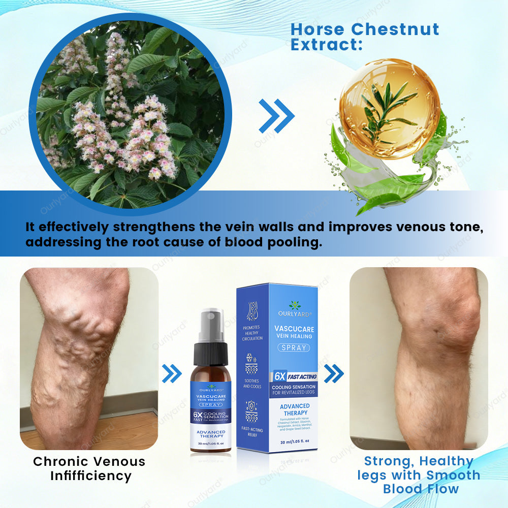 🇦🇺✅Ourlyard® VascuCare Vein Healing Spray(Designed for Varicose veins, Spider veins, Deep vein Thrombosis, Chronic venous insufficiency, Venous ulcers, Thrombophlebitis and other venous issues)