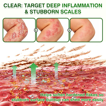 🇦🇺🏅🛡️✅DOCTIA® SkinRecovery Reishi Psoriasis Repair Spray