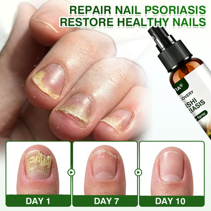 🇦🇺🏅🛡️✅DOCTIA® SkinRecovery Reishi Psoriasis Repair Spray