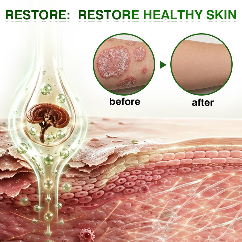 🇦🇺🏅🛡️✅DOCTIA® SkinRecovery Reishi Psoriasis Repair Spray