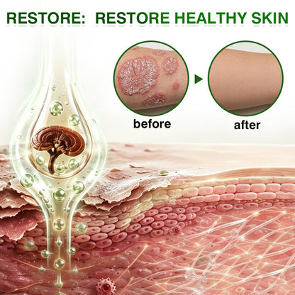 🇦🇺🏅🛡️✅DOCTIA® SkinRecovery Reishi Psoriasis Repair Spray