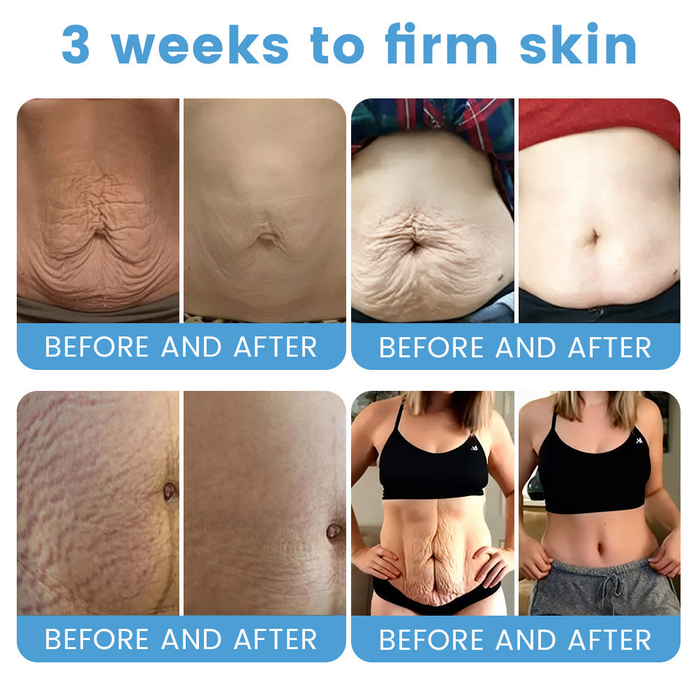 🇦🇺🎁Rolimey® Botox + Retinol Skin Firming & Lifting Cream⏰For Aging issues