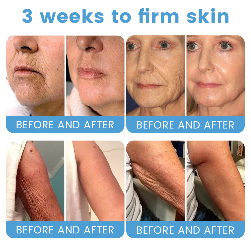 🇦🇺🎁Rolimey® Botox + Retinol Skin Firming & Lifting Cream⏰For Aging issues