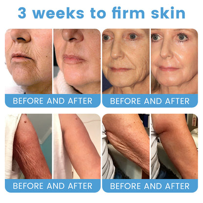 🇦🇺🎁Rolimey® Botox + Retinol Skin Firming & Lifting Cream⏰For Aging issues