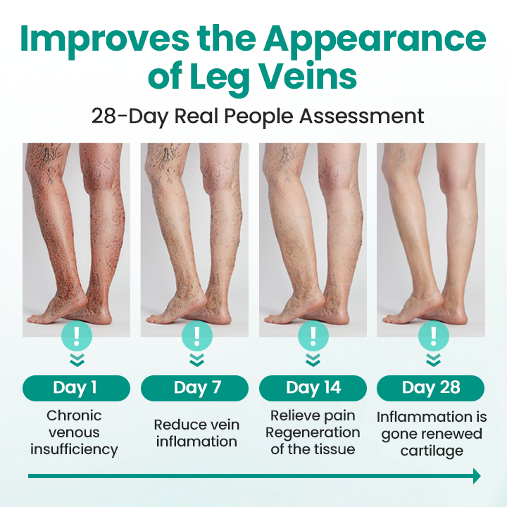 🇦🇺⚡Instant Relief, Long-Term Results🥇🌿GFOUK® LegRenew Varicose Veins Patch
