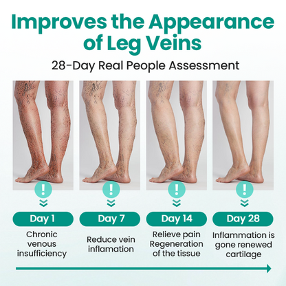 🇦🇺⚡Instant Relief, Long-Term Results🥇🌿GFOUK® LegRenew Varicose Veins Patch