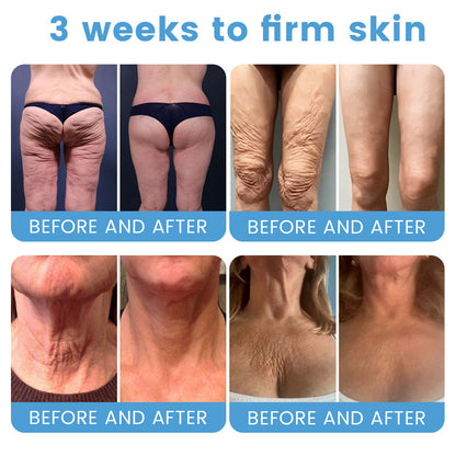 🇦🇺🎁Rolimey® Botox + Retinol Skin Firming & Lifting Cream⏰For Aging issues