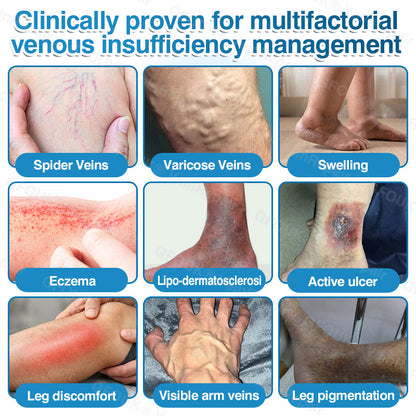 🇦🇺✅👨‍⚕️🫶GFOUK® VeinRepair Microneedle Patch Roll⚡Instant Relief, Long-Term Results