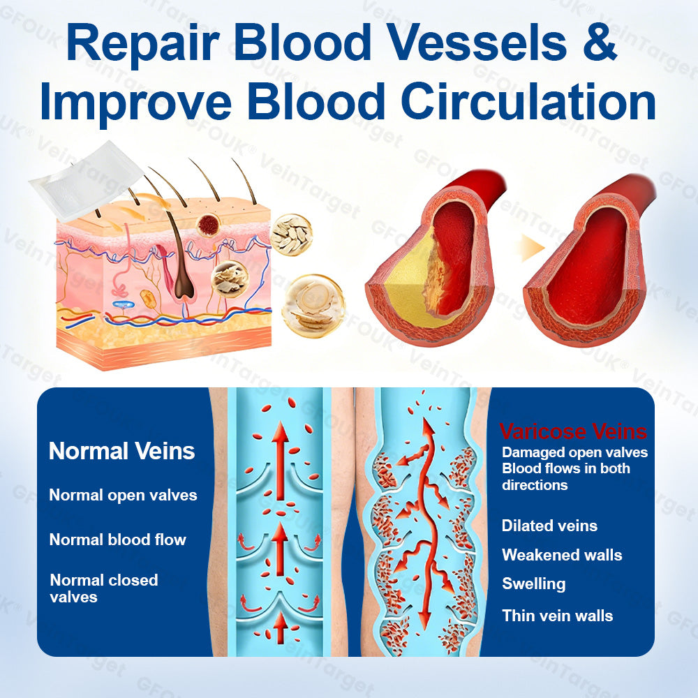 🇦🇺👨‍⚕️✨🌿GFOUK® VeinTarget Microneedle Patch⚡Instant Relief, Long-Term Results