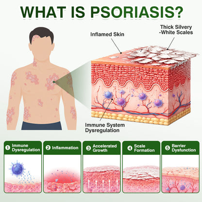 🇦🇺🏅🛡️✅DOCTIA® SkinRecovery Reishi Psoriasis Repair Spray