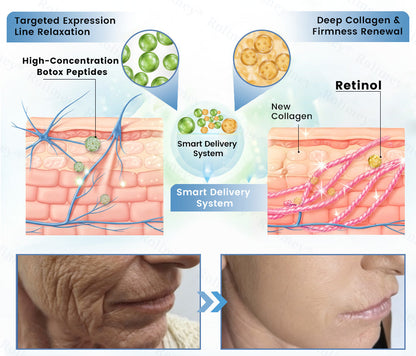 🇦🇺🎁Rolimey® Botox + Retinol Skin Firming & Lifting Cream⏰For Aging issues