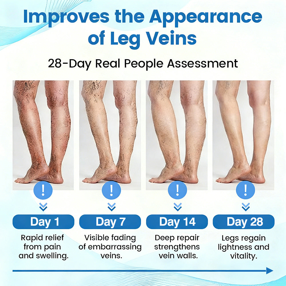 🇦🇺💃🌿GFOUK® VascuCare Vein Healing Spray(Designed for Varicose veins, Spider veins, Deep vein Thrombosis, Chronic venous insufficiency, Venous ulcers, Thrombophlebitis and other venous issues)